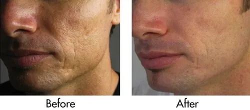 Comparative skin treatment results: before and after.