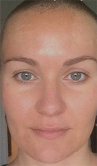 Individual with a shaved head and clear skin.