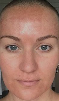 Person with shaved head and clear skin.