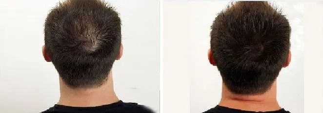Before and after hairstyle transformation comparison.