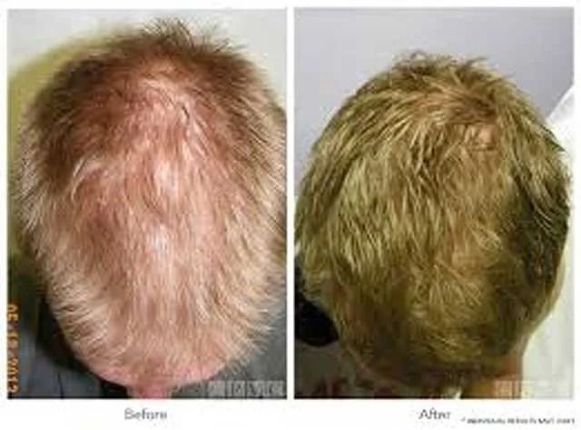 Before and after hair transformation comparison.