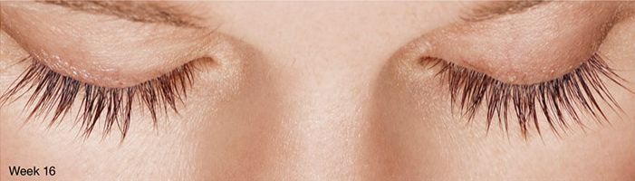 Chemabrasion Before & After