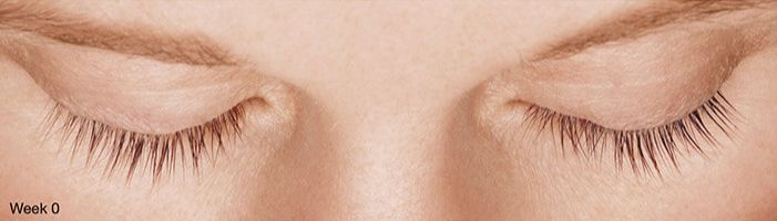 Chemabrasion Before & After