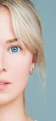 Microneedling Before & After