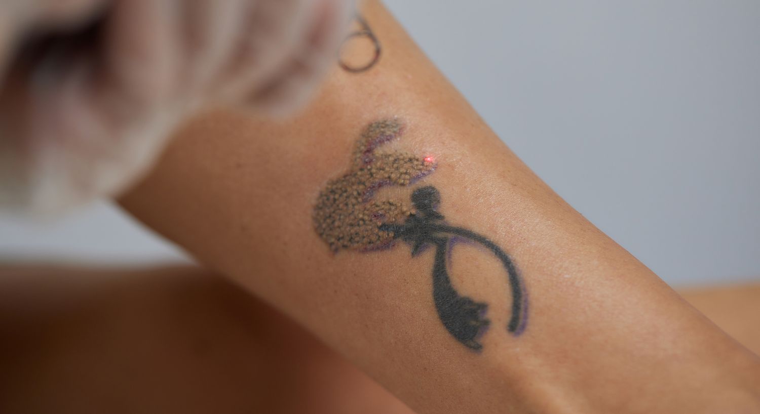 Hand applying ink to a tattoo on arm.