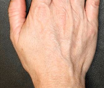 Close-up of a human hand on gray background.
