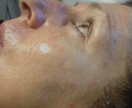 Face with skincare treatment, glowing skin.