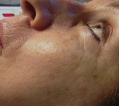 Close-up of a person's face, showing skin texture.