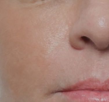 Close-up of a person's face features.
