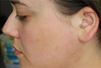 Middle-aged woman with minimal makeup, neutral expression.