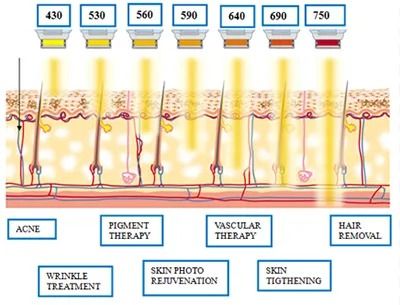 Light therapy applications for various skin conditions.