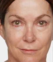 Middle-aged woman with minimal makeup, neutral expression.
