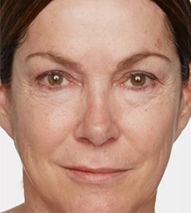 Woman with natural facial features and light makeup.