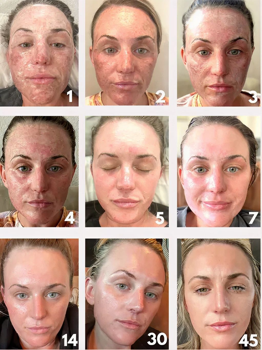 Skincare progress over several days displayed visually.