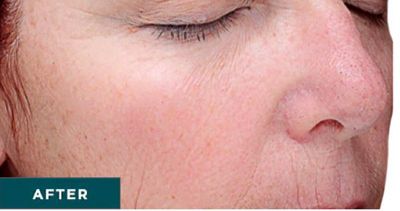 Middle-aged woman with minimal makeup, neutral expression.