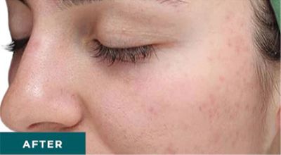 Middle-aged woman with minimal makeup, neutral expression.